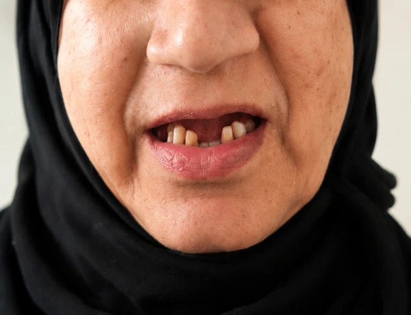 Oman Patient Before