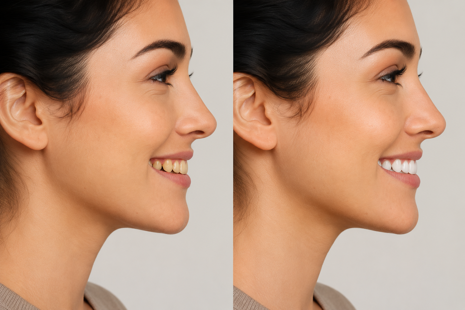 Cosmetic Smile Makeover